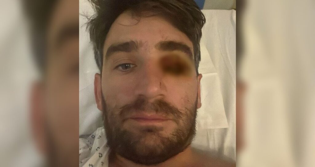 Accidente de Año Nuevo en Tampa Bay: Hombre pierde el ojo debido a explosión pirotécnica