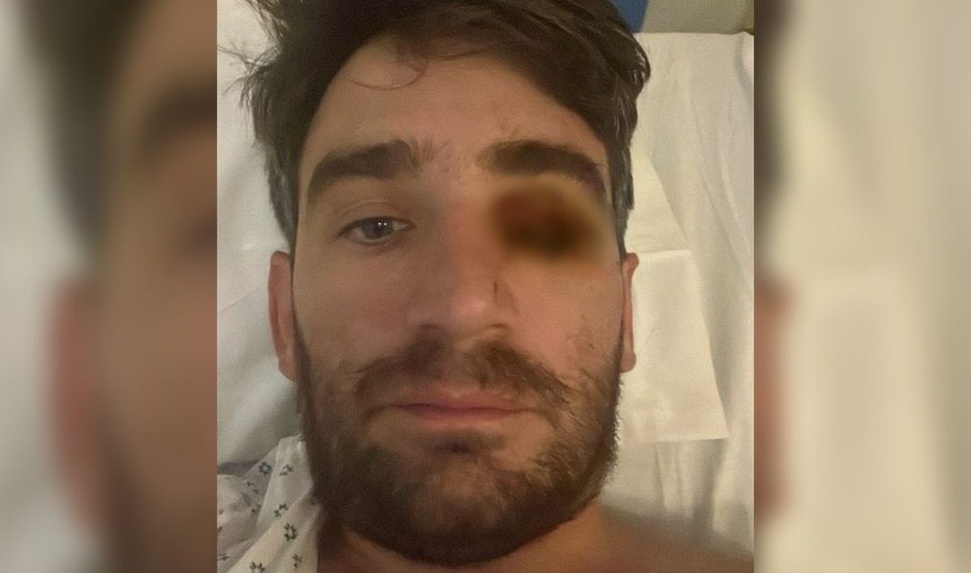 Accidente de Año Nuevo en Tampa Bay: Hombre pierde el ojo debido a explosión pirotécnica