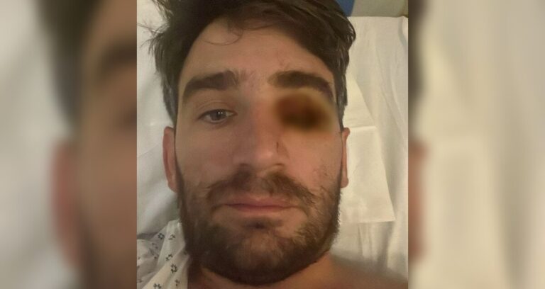 Accidente de Año Nuevo en Tampa Bay: Hombre pierde el ojo debido a explosión pirotécnica